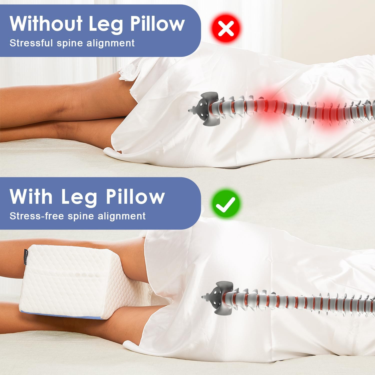 Cooloo8 Knee Pillow for Side Sleepers - Sciatica Pain Relief 1PCS